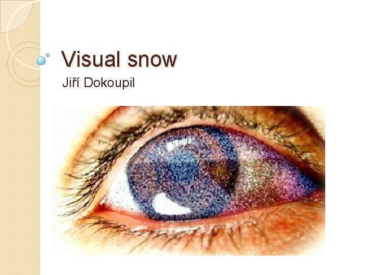 Visual snow Jiří Dokoupil 