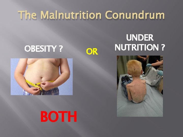 The Malnutrition Conundrum OBESITY ? BOTH OR UNDER NUTRITION ? 