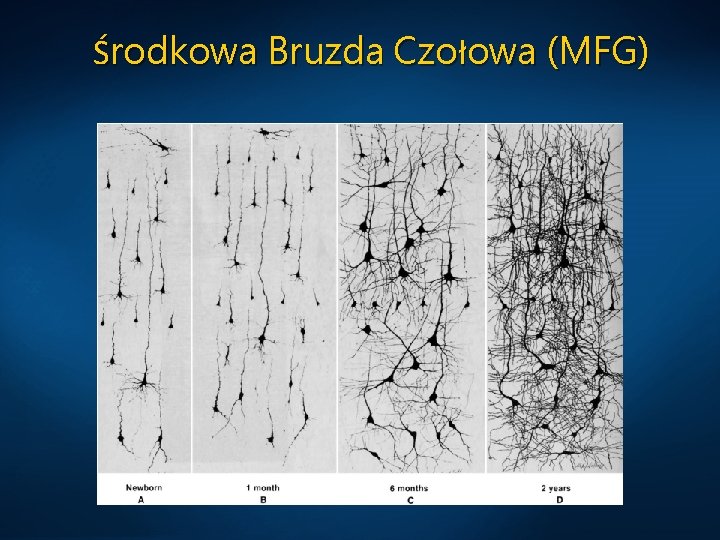 Środkowa Bruzda Czołowa (MFG) 