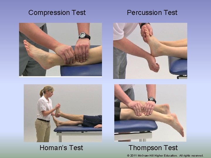 Compression Test Homan’s Test Percussion Test Thompson Test © 2011 Mc. Graw-Hill Higher Education.