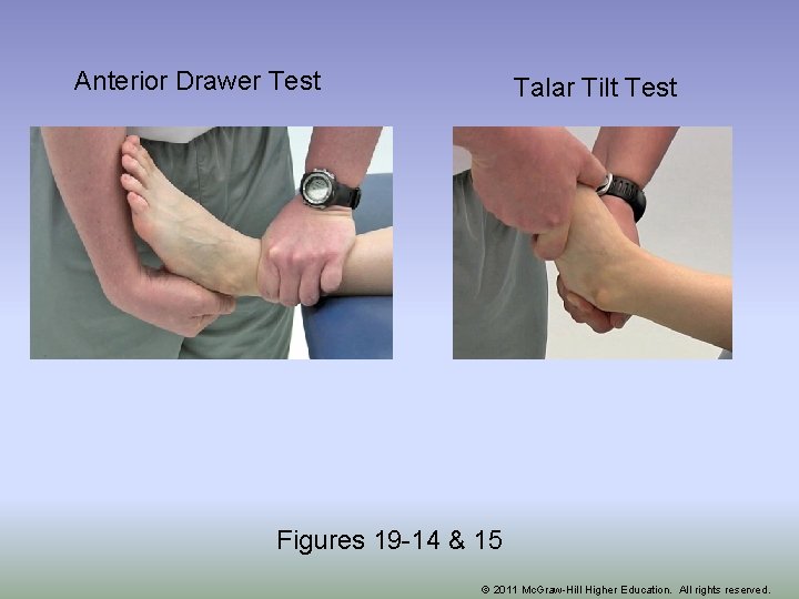 Anterior Drawer Test Talar Tilt Test Figures 19 -14 & 15 © 2011 Mc.