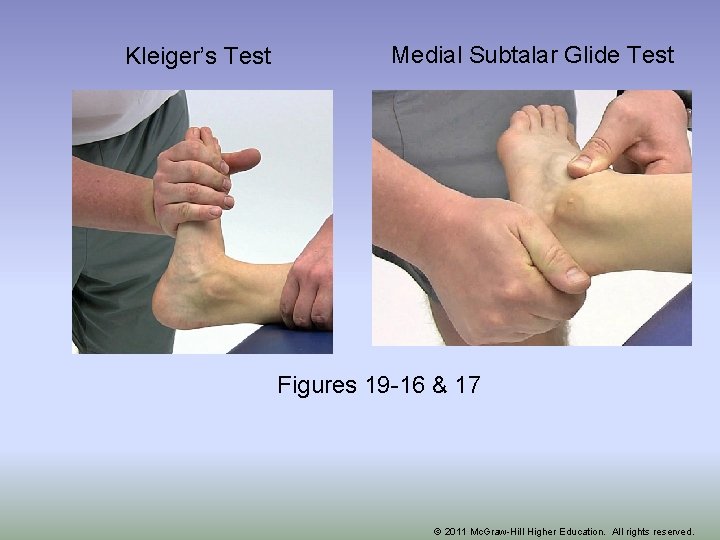 Kleiger’s Test Medial Subtalar Glide Test Figures 19 -16 & 17 © 2011 Mc.