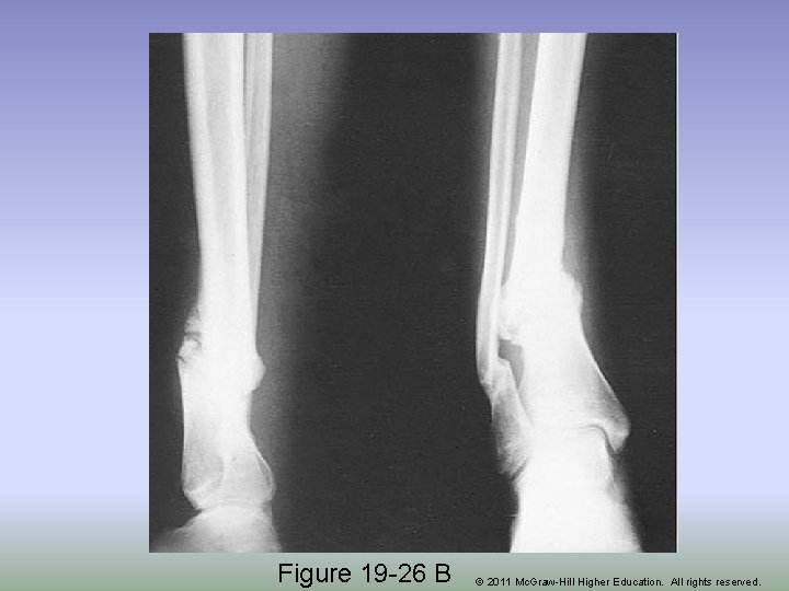 Figure 19 -26 B © 2011 Mc. Graw-Hill Higher Education. All rights reserved. 