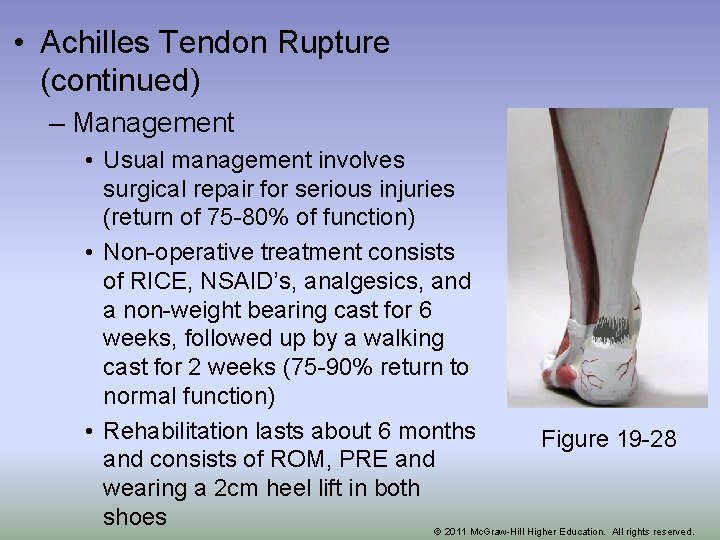  • Achilles Tendon Rupture (continued) – Management • Usual management involves surgical repair