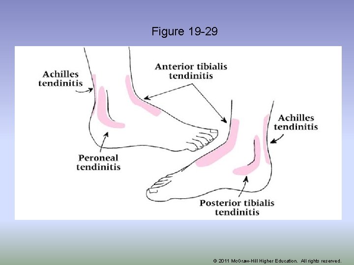 Figure 19 -29 © 2011 Mc. Graw-Hill Higher Education. All rights reserved. 