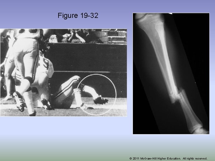 Figure 19 -32 © 2011 Mc. Graw-Hill Higher Education. All rights reserved. 