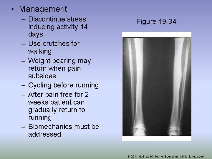  • Management – Discontinue stress inducing activity 14 days – Use crutches for