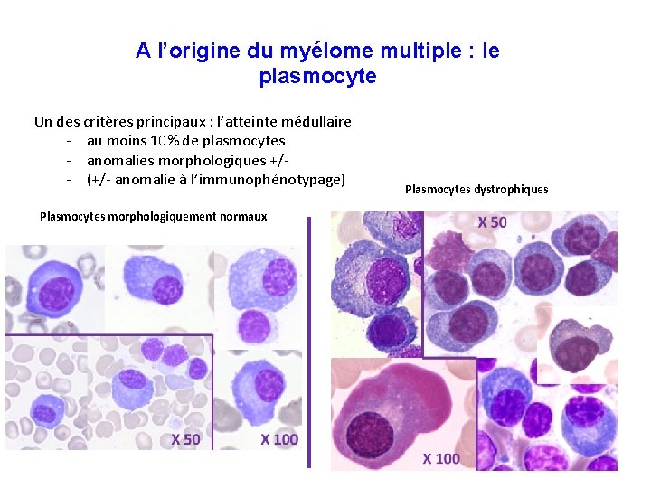 A l’origine du myélome multiple : le plasmocyte Un des critères principaux : l’atteinte