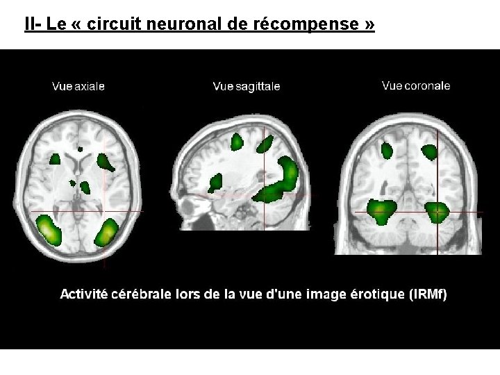 II- Le « circuit neuronal de récompense » 