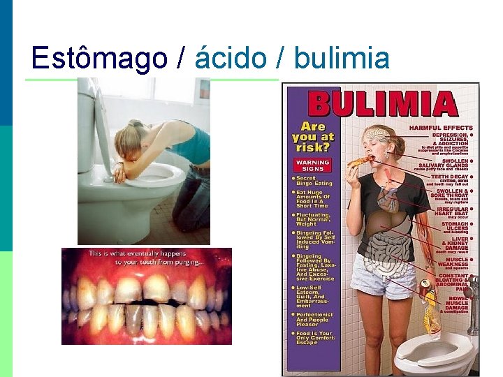 Estômago / ácido / bulimia 