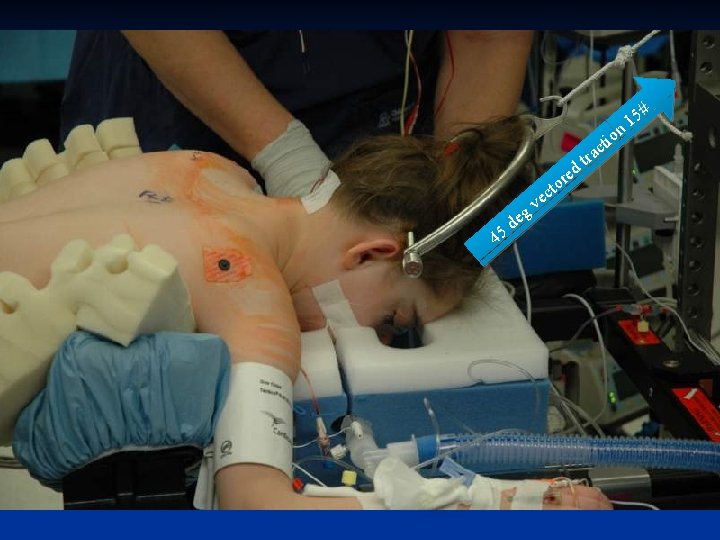 5# 1 n r tio c a r t d e to c e 5# 1 n r tio c a r t d e to c e