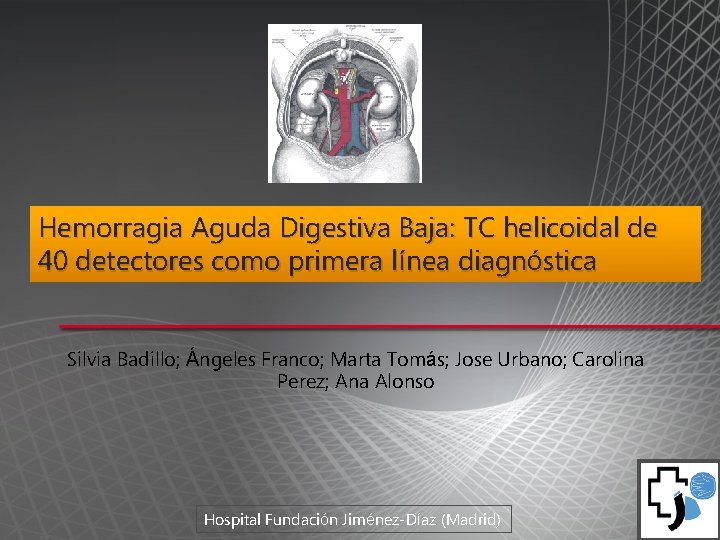 Hemorragia Aguda Digestiva Baja: TC helicoidal de 40 detectores como primera línea diagnóstica Silvia