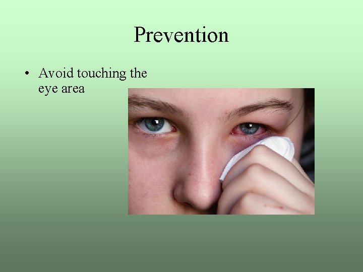 Prevention • Avoid touching the eye area 