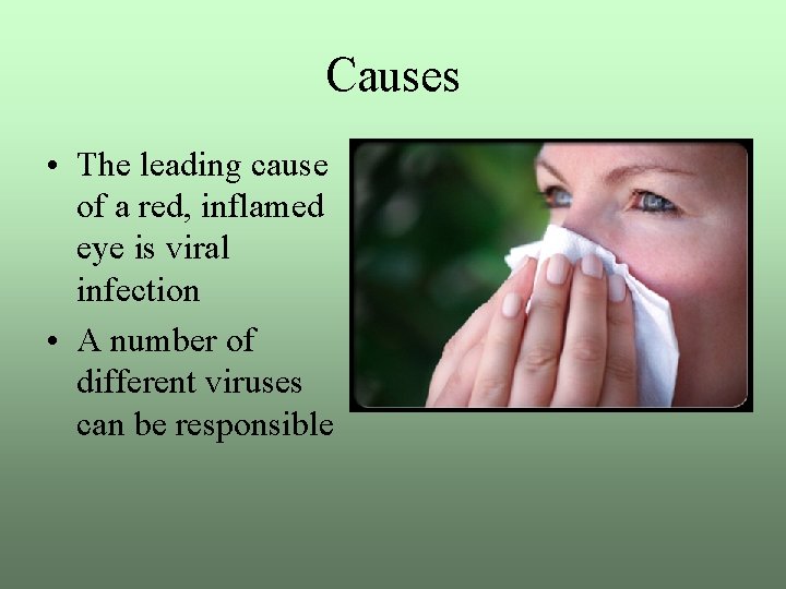 Causes • The leading cause of a red, inflamed eye is viral infection •