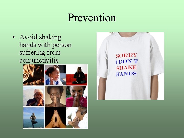 Prevention • Avoid shaking hands with person suffering from conjunctivitis 