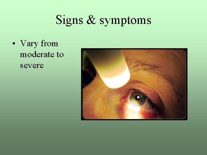 Signs & symptoms • Vary from moderate to severe 