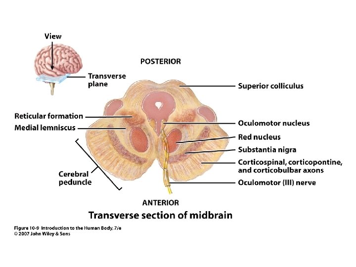 Figure 10. 9 