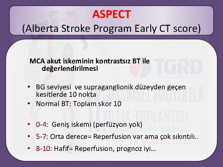 ASPECT (Alberta Stroke Program Early CT score) MCA akut iskeminin kontrastsız BT ile değerlendirilmesi