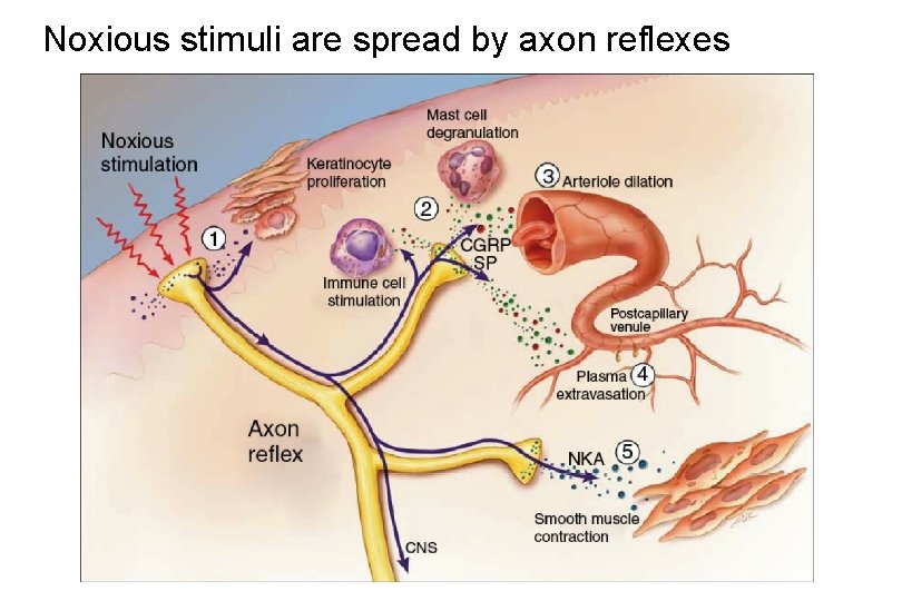 Noxious stimuli are spread by axon reflexes 