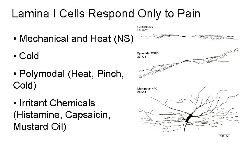 Lamina I Cells Respond Only to Pain • Mechanical and Heat (NS) • Cold