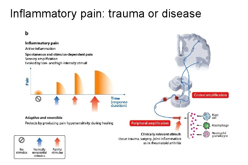 Inflammatory pain: trauma or disease 
