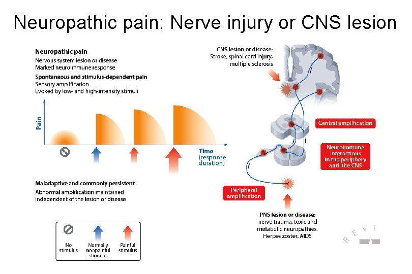 Neuropathic pain: Nerve injury or CNS lesion 