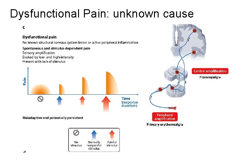 Dysfunctional Pain: unknown cause 