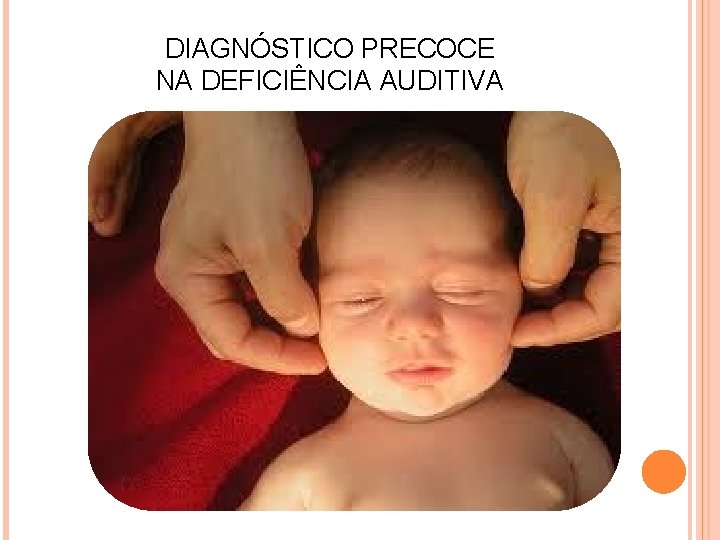 DIAGNÓSTICO PRECOCE NA DEFICIÊNCIA AUDITIVA 