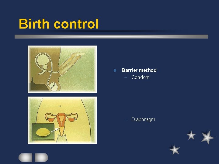 Birth control l Barrier method – Condom – Diaphragm 