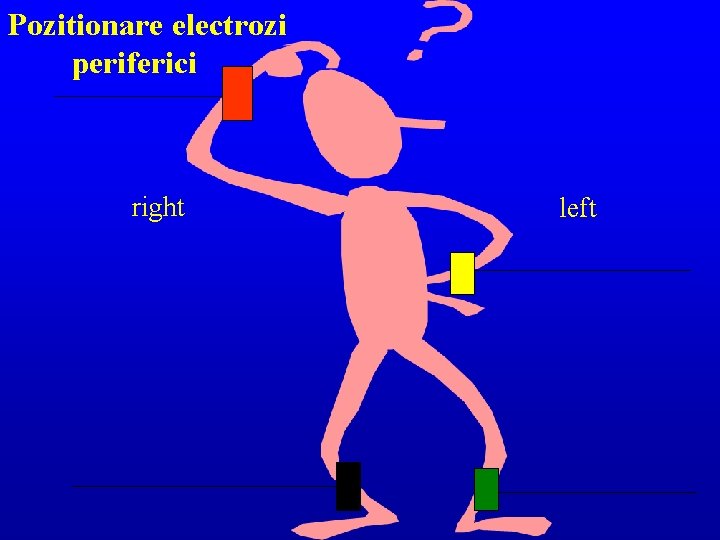 Pozitionare electrozi periferici right left 