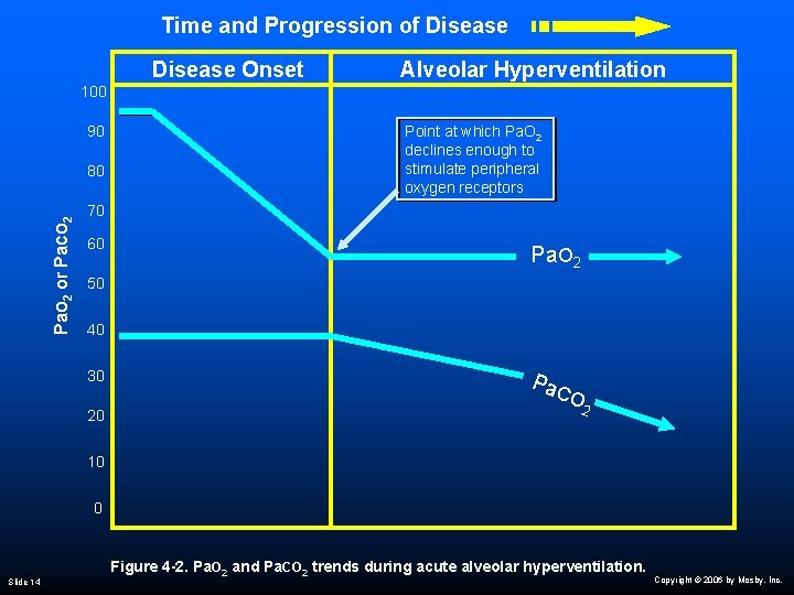 Time and Progression of Disease Onset Alveolar Hyperventilation 100 90 Pa. O 2 or