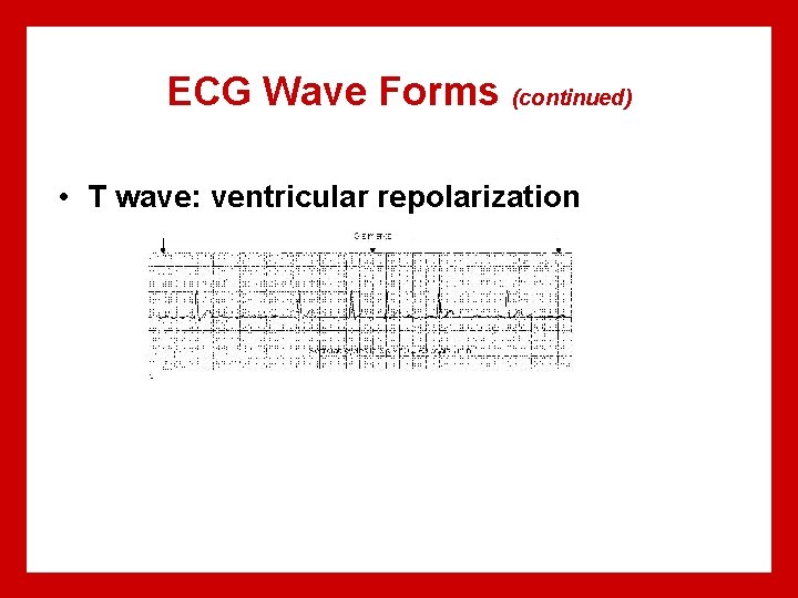 ECG Wave Forms (continued) • T wave: ventricular repolarization 