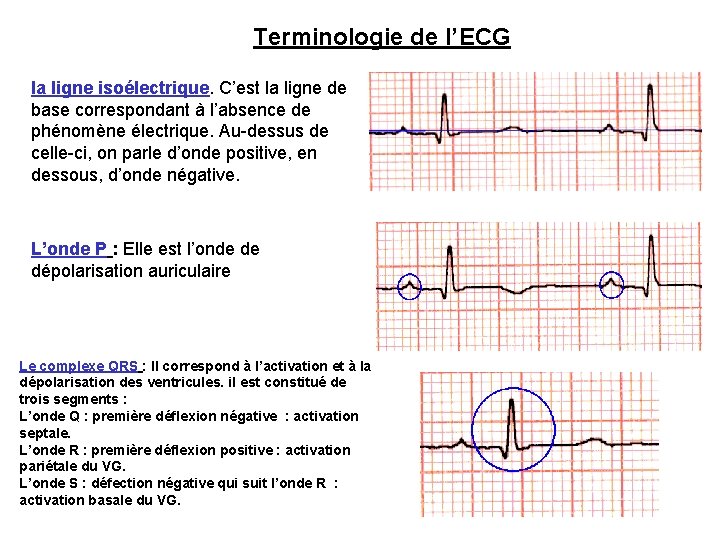 Terminologie de l’ECG la ligne isoélectrique. C’est la ligne de base correspondant à l’absence