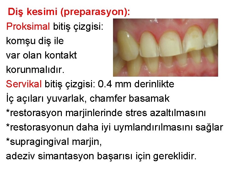 Diş kesimi (preparasyon): Proksimal bitiş çizgisi: komşu diş ile var olan kontakt korunmalıdır. Servikal