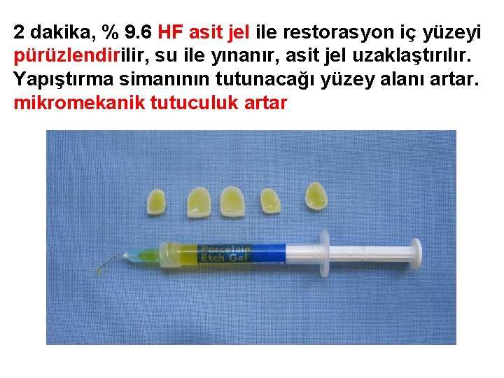 2 dakika, % 9. 6 HF asit jel ile restorasyon iç yüzeyi pürüzlendirilir, su