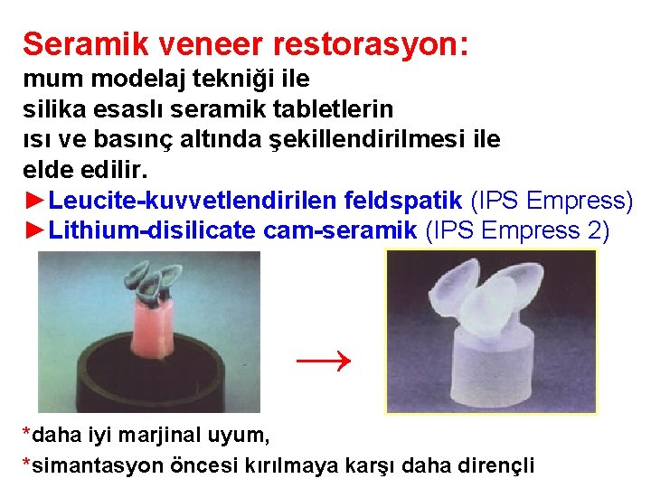 Seramik veneer restorasyon: mum modelaj tekniği ile silika esaslı seramik tabletlerin ısı ve basınç