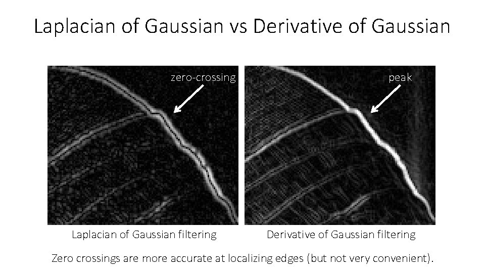 Laplacian of Gaussian vs Derivative of Gaussian zero-crossing Laplacian of Gaussian filtering peak Derivative