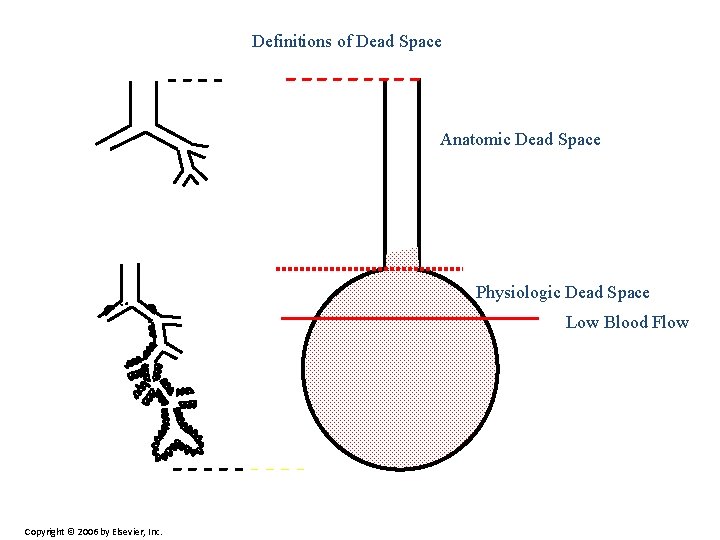 Definitions of Dead Space Anatomic Dead Space Physiologic Dead Space Low Blood Flow Copyright