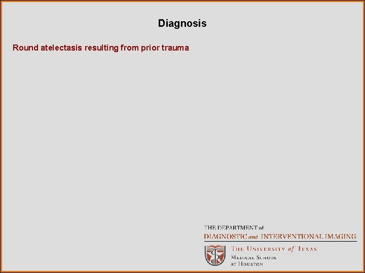 Diagnosis Round atelectasis resulting from prior trauma 