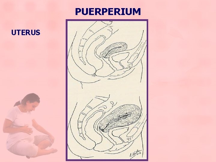 PUERPERIUM UTERUS 