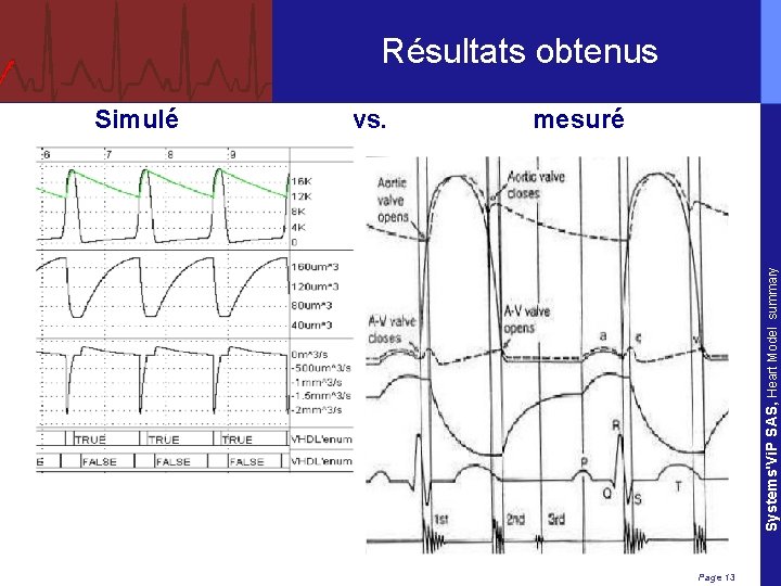 Résultats obtenus vs. mesuré Systems'Vi. P SAS, Heart Model summary Simulé Page 13 