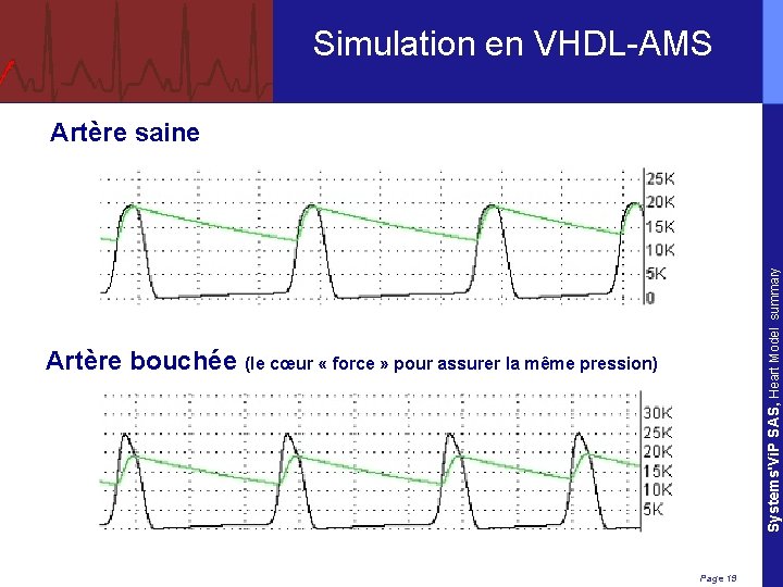 Simulation en VHDL-AMS Systems'Vi. P SAS, Heart Model summary Artère saine Artère bouchée (le