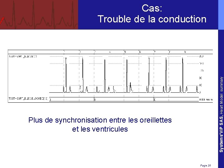 Systems'Vi. P SAS, Heart Model summary Cas: Trouble de la conduction Plus de synchronisation