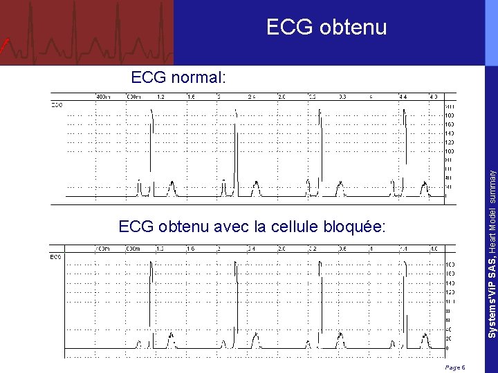 ECG obtenu Systems'Vi. P SAS, Heart Model summary ECG normal: ECG obtenu avec la