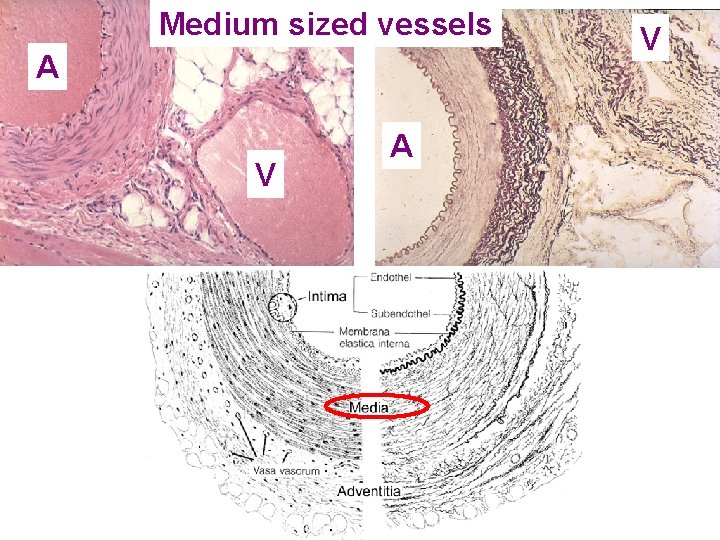 Medium sized vessels A V 