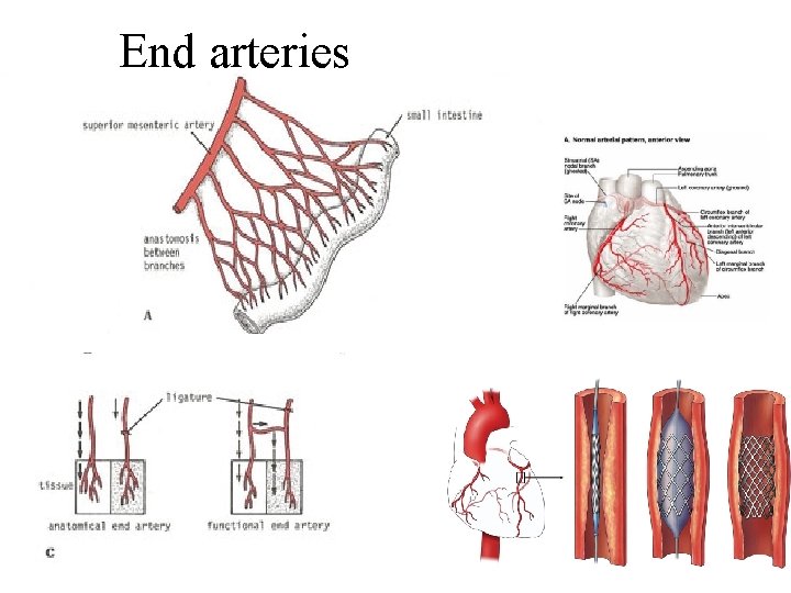 End arteries 