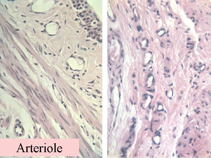 Arteriole 