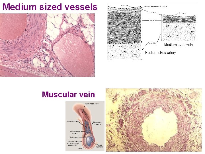 Medium sized vessels Medium-sized vein Medium-sized artery Muscular vein 