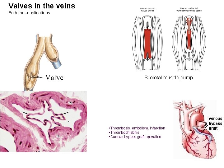 Valves in the veins Endothel-duplications Valve Skeletal muscle pump • Thrombosis, embolism, infarction •