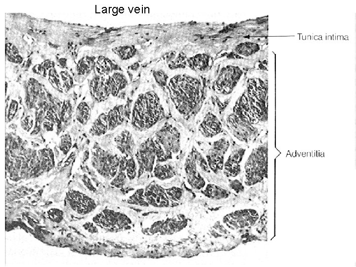 Large vein 